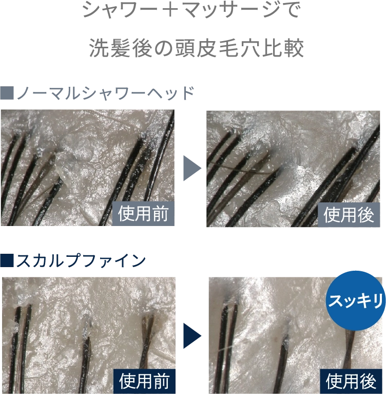 シャワー＋マッサージで洗髪後の頭皮毛穴比較